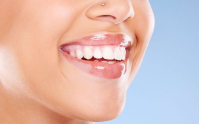 Un sorriso perfetto senza stress: i vantaggi delle faccette dentali